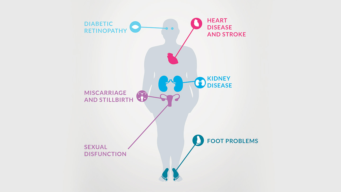 Early diagnosis & diet can increase reversal rates of type 2 diabetes