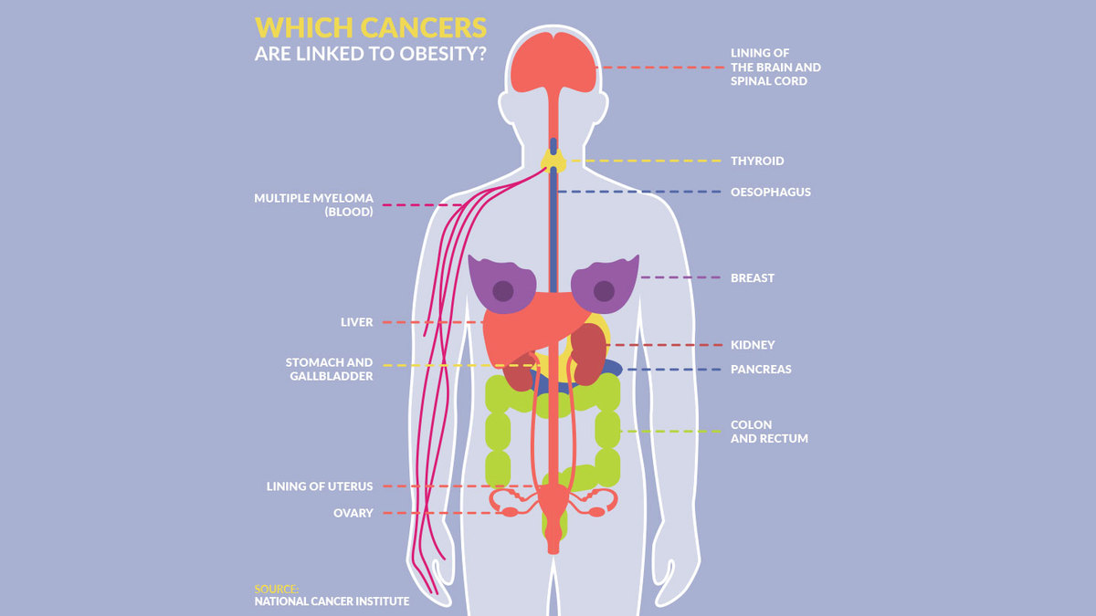 Obesity, cancer, blame and shame