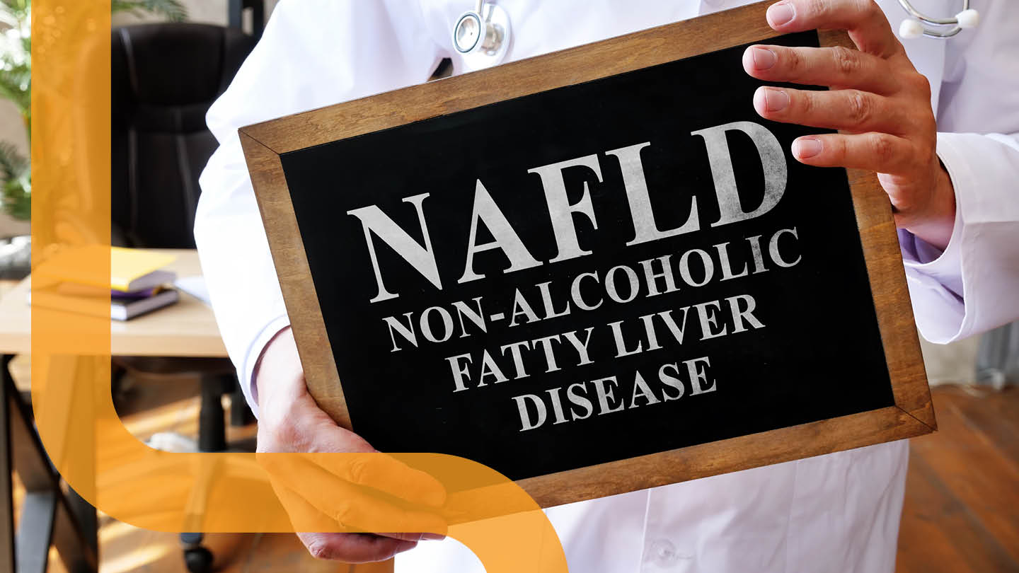 Obesity and Non-alcoholic Fatty Liver Disease: How to improve your liver