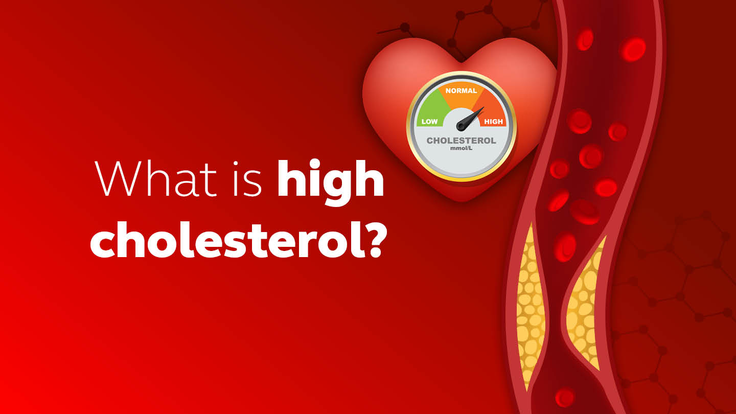 What is a high cholesterol and how can we improve it?
