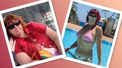 Ann Before And After