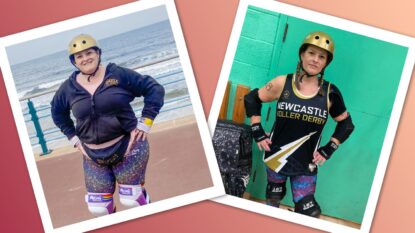 Helen Before And After