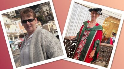 Janice Before And After