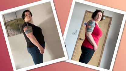 Siobhan Before And After